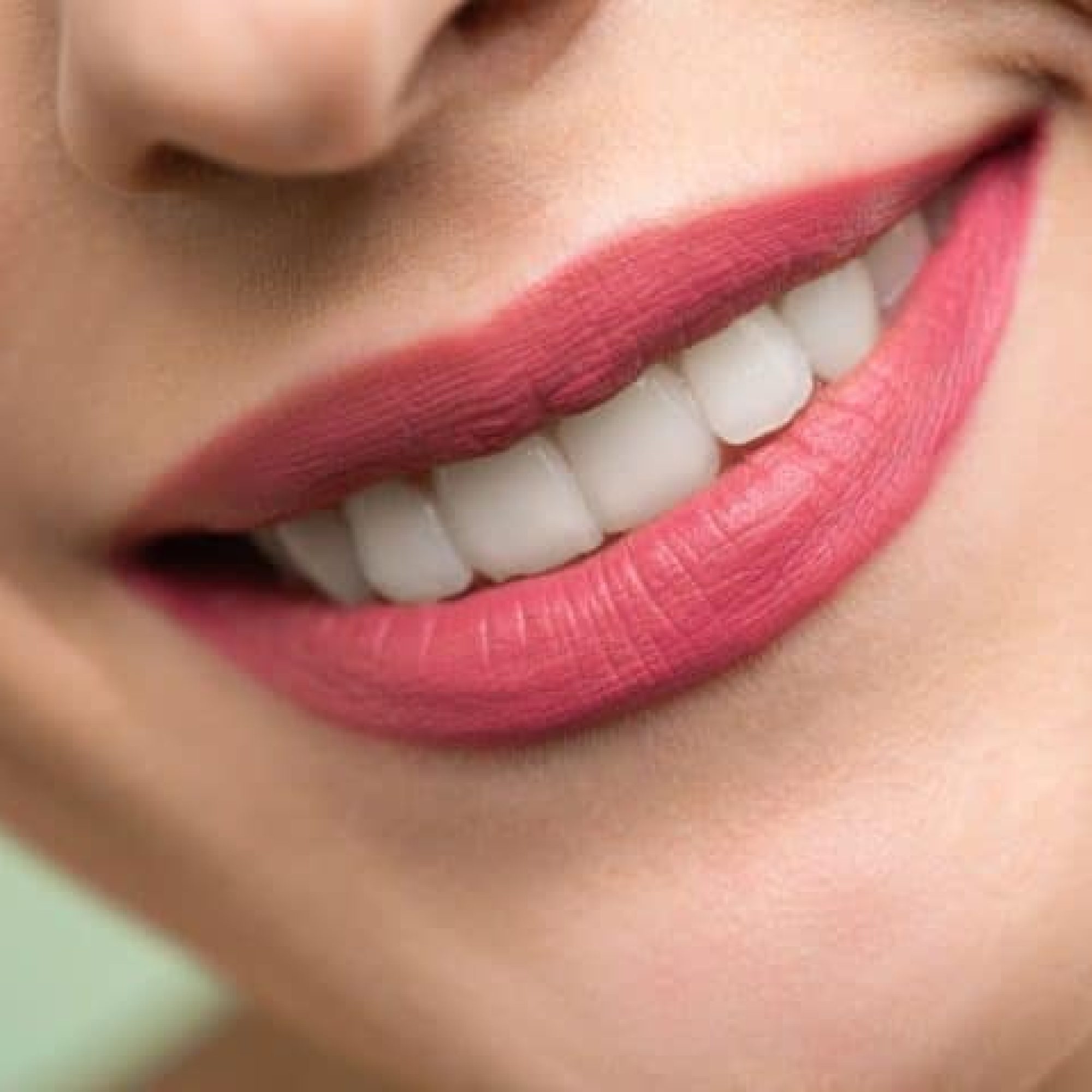 Smile Makeover vs Veneers: Understanding the Differences and Choosing the Right Option