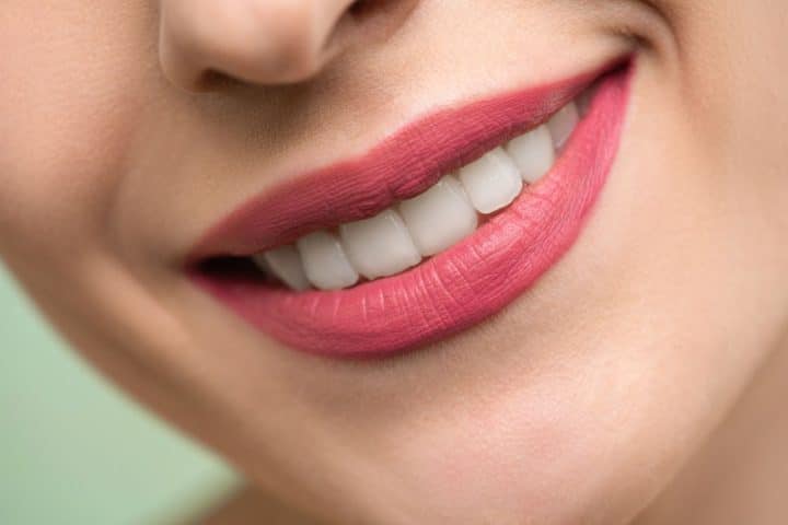 Smile Makeover vs Veneers: Understanding the Differences and Choosing the Right Option